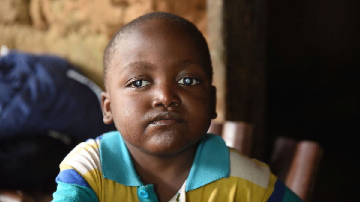 Kleiner afrikanischer Junge mit weißen Pupillen