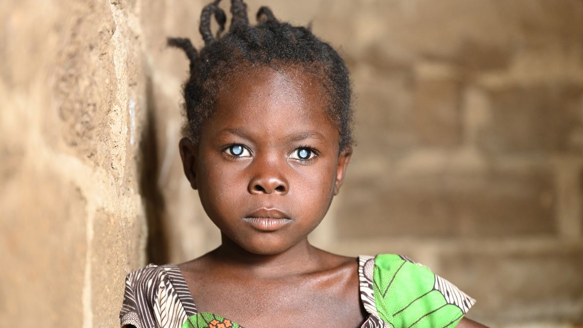 Ein etwa achtjähriges Mädchen steht vor einer gemauerten Zimmerwand. Das Kind hat auffallend weiße Pupillen.