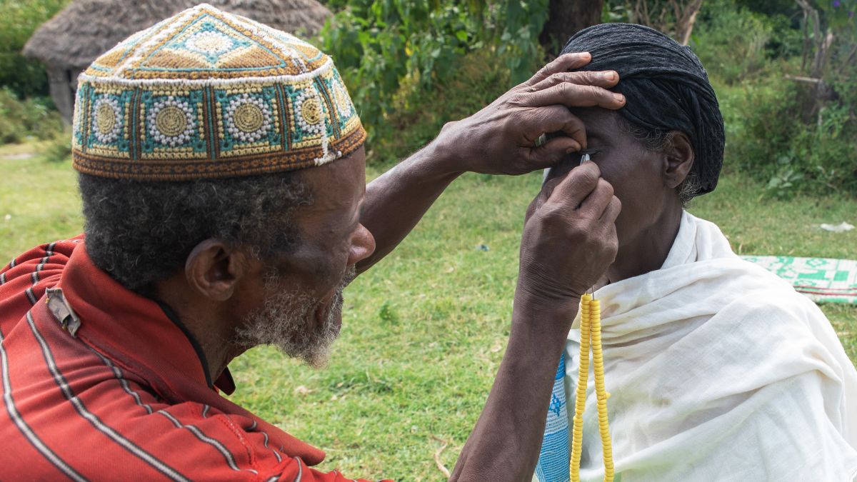 Ein Mann reißt seiner Ehefrau die Wimpern mit einer Pinzette aus.