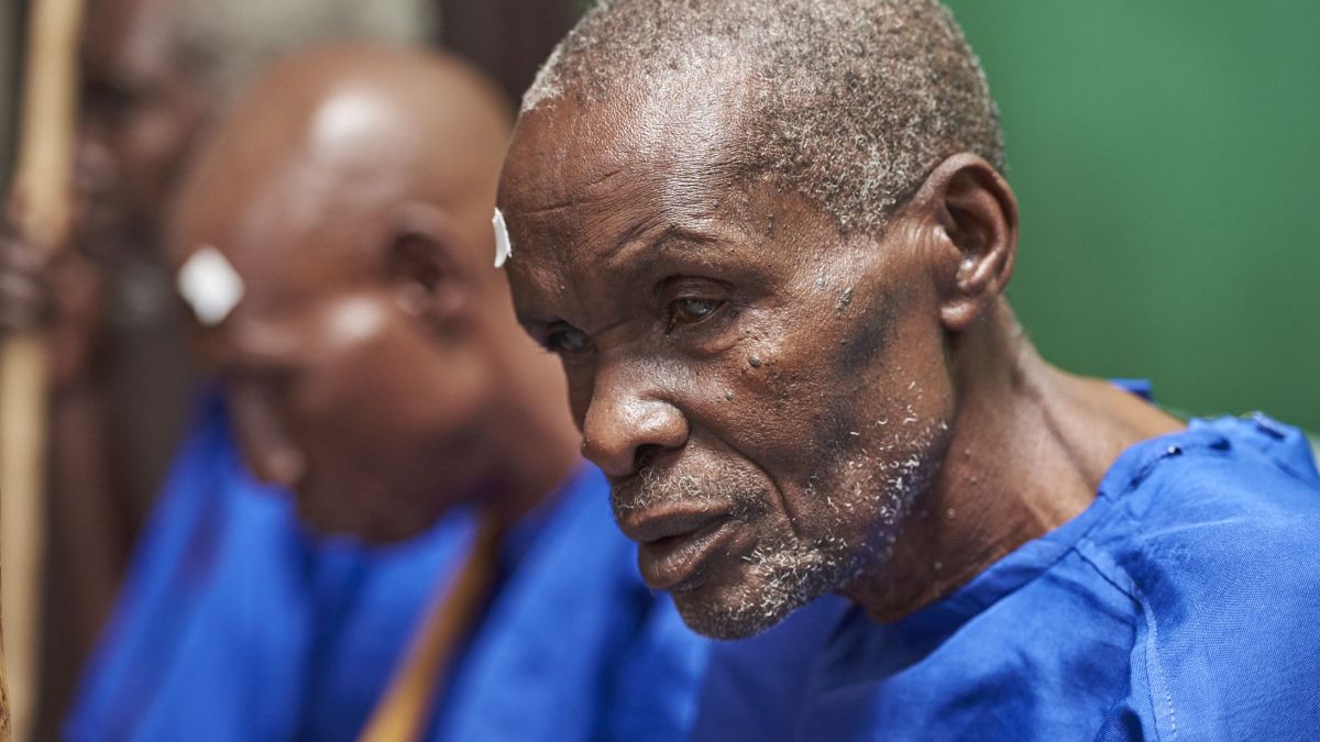 Afrikanischer Mann mit blauem Hemd und Pflaster über dem rechten Auge