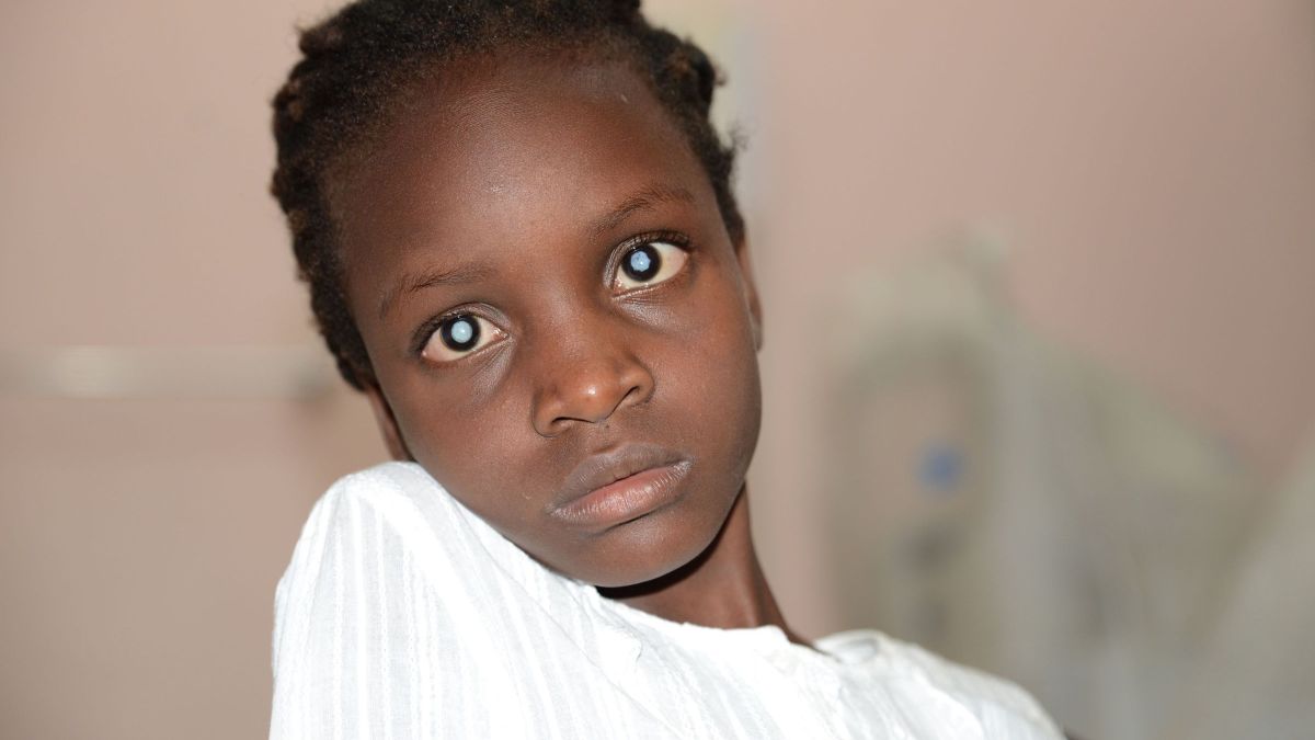 Porträt eines afrikanischen Mädchens, das Grauen Star hat.