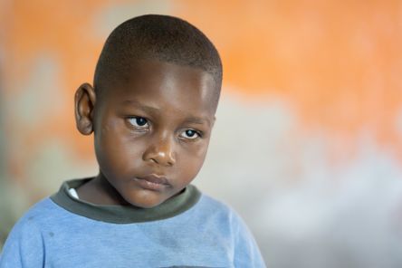 Ein etwa vierjähriges Kind hat hell schimmernde Pupillen.