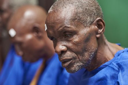 Afrikanischer Mann mit blauem Hemd und Pflaster über dem rechten Auge