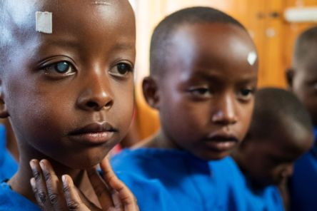 Kinder in OP-Hemd und Markierungspflaster auf der Stirn