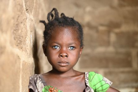 Ein Mädchen, auf dessen Augen ein grauer Schleier zu sehen ist.