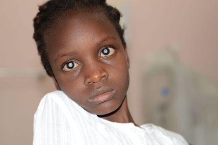 Porträt eines afrikanischen Mädchens, das Grauen Star hat.