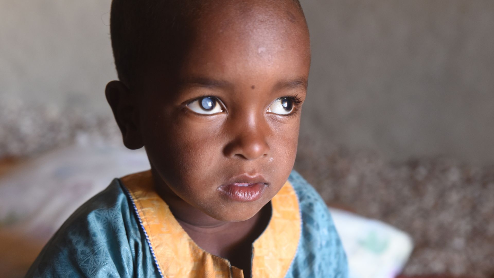 Kleiner Junge im bunten Kaftan mit auffällig weißen Pupillen