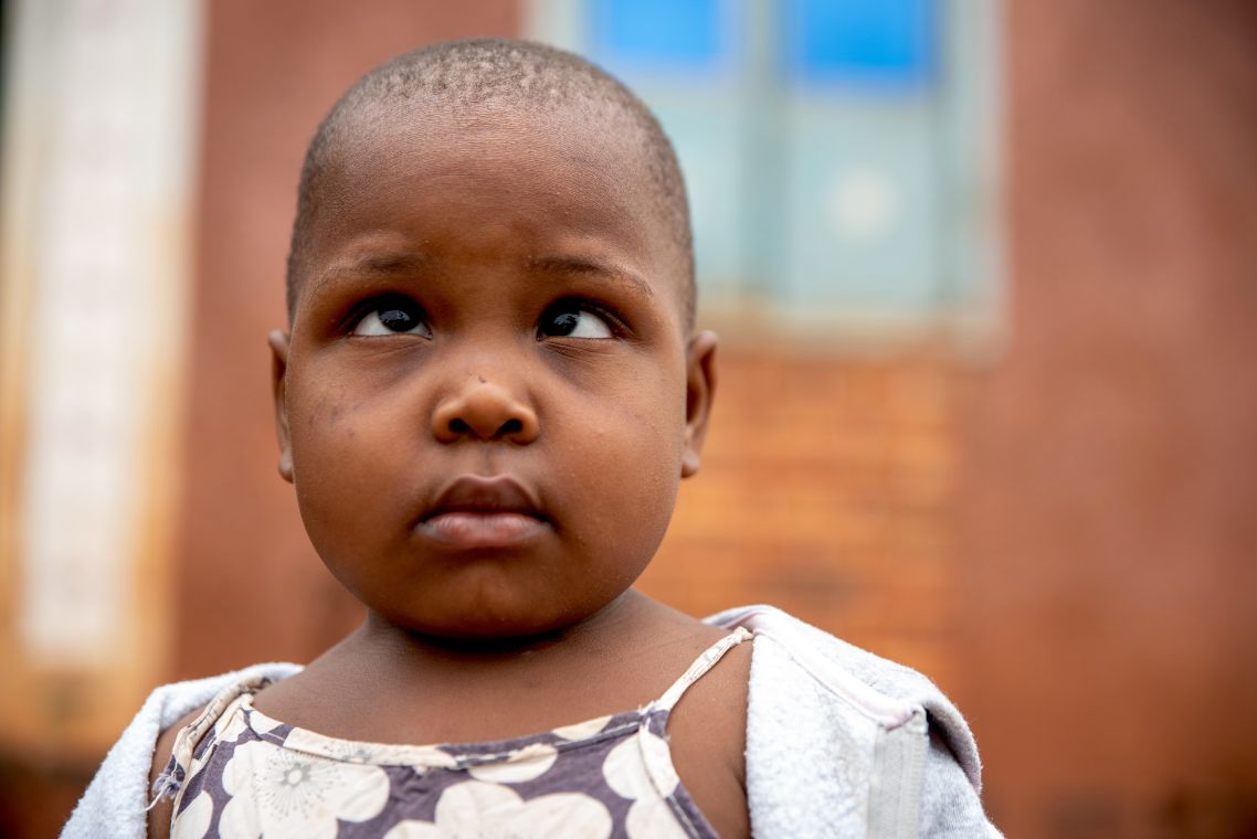 Ein Kind mit schiefstehenden Augen