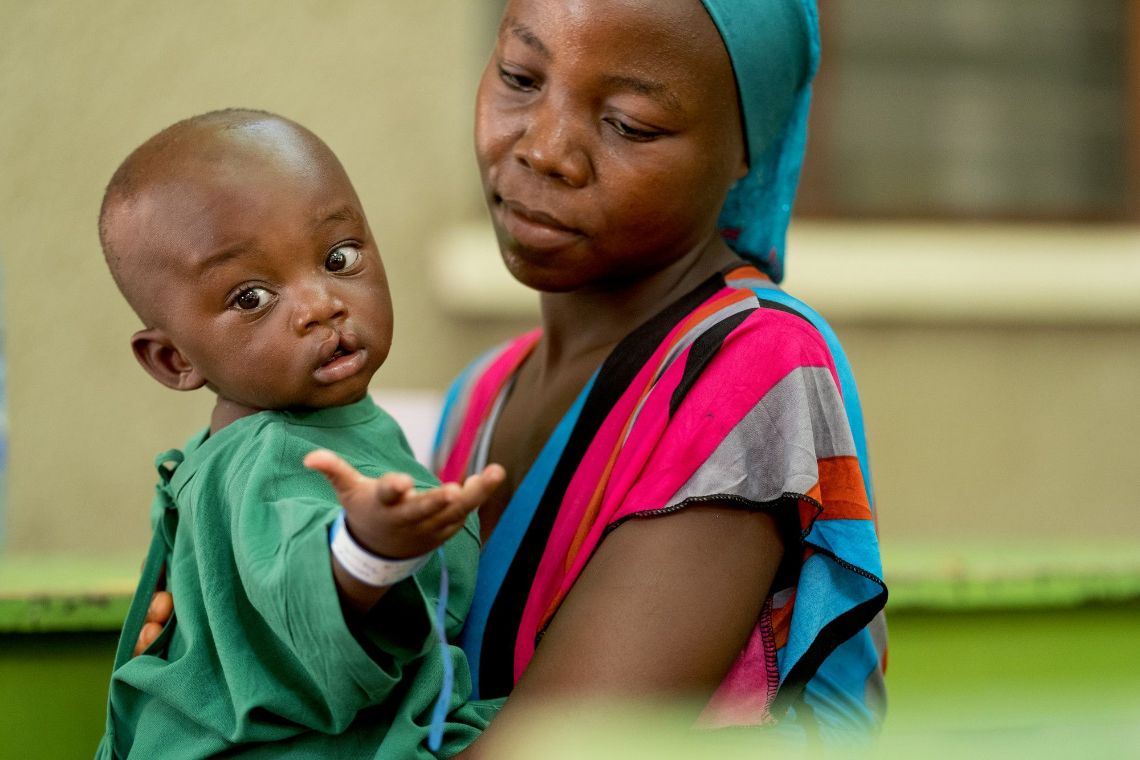 Ein Baby mit Lippen-Kiefer-Gaumenspalte