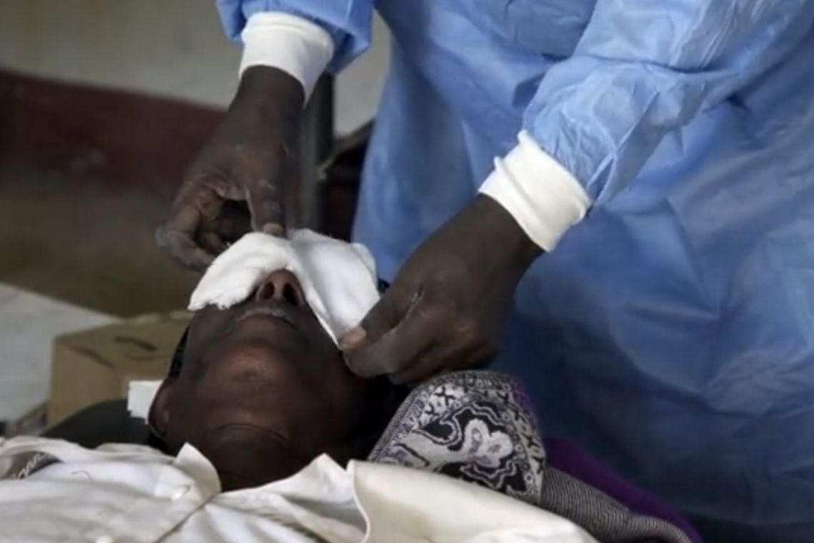 Ein Mann streicht einem Kind Salbe in die Augen.