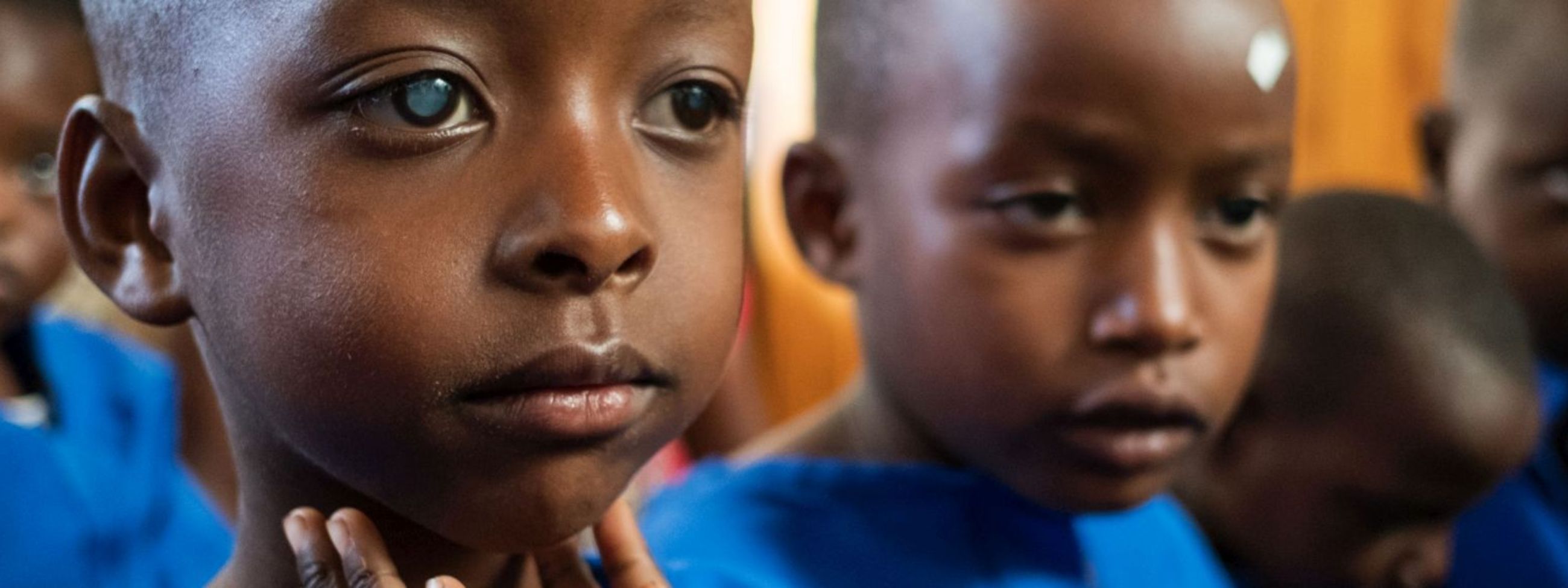 Kinder in OP-Hemd und Markierungspflaster auf der Stirn