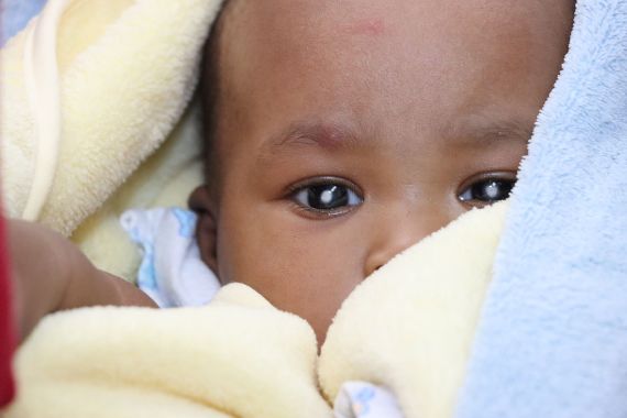 Ein Baby mit weißen Punkten auf den Pupillen