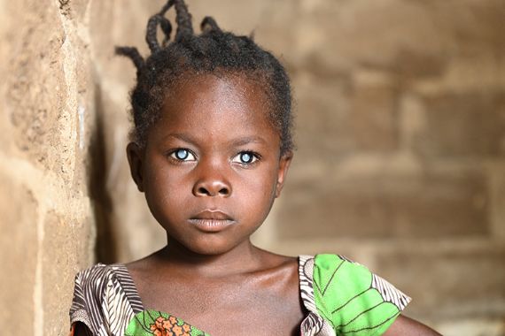 Ein kleines Mädchen mit auffallend weißen Pupillen lehnt sich in einem Raum an eine gemauerte Wand.
