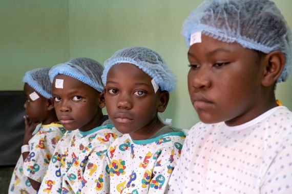 Vier Kinder im Alter von etwa fünf bis 14 Jahren sitzen nebeneinander. Sie tragen OP-Kleidung und haben jeweils ein Pflaster auf der Stirn.