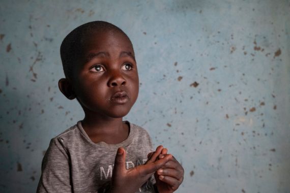 Ein etwa dreijähriger Junge mit auffallend weißen Pupillen.
