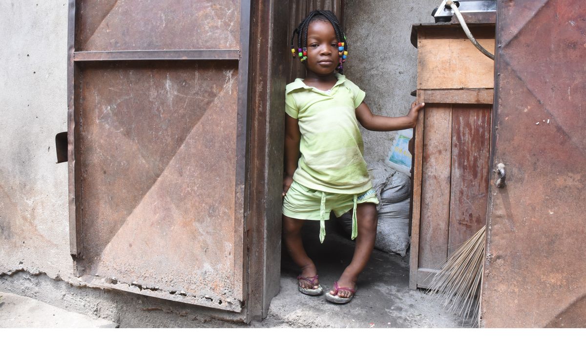 Kleines schwarzes Mädchen mit O-Beinen