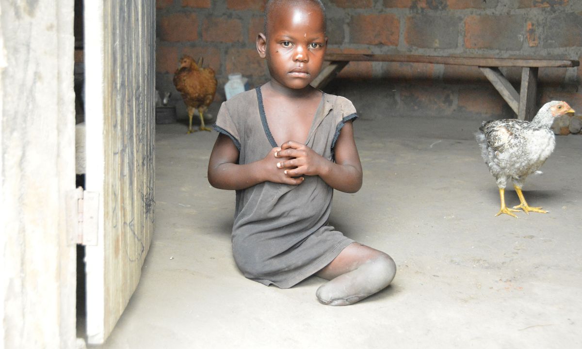 Ein beinamputiertes afrikanisches Mädchen sitzt auf dem Boden einer Hütte, neben ihm ein Huhn.